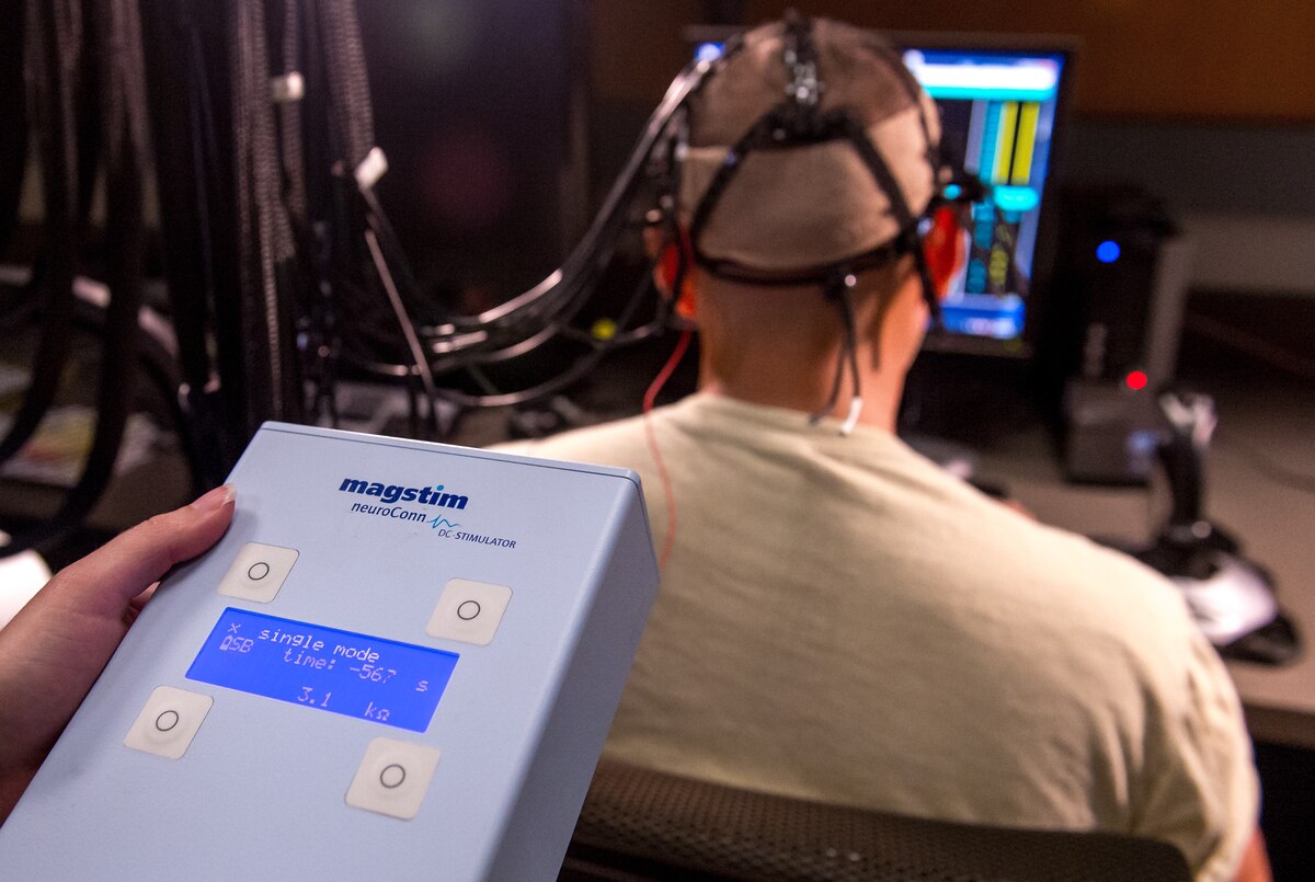 کاربرد tDCS