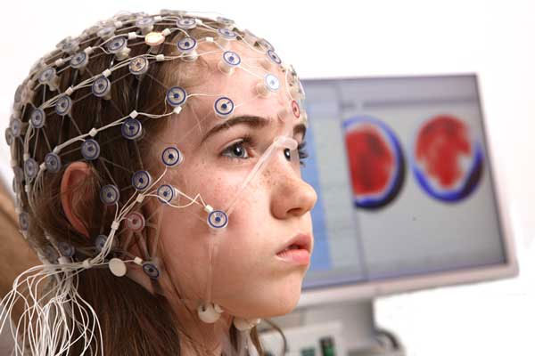 دستگاه TDCS