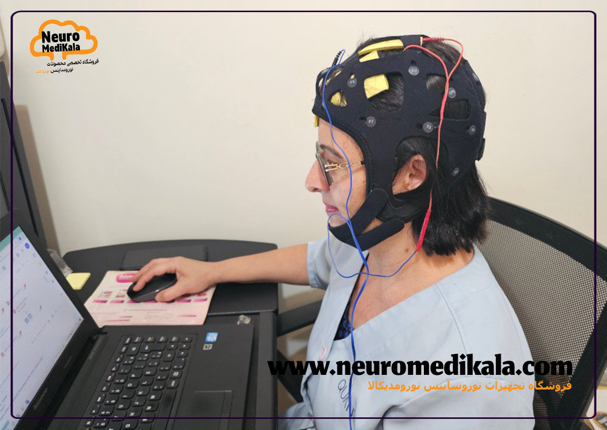 دستگاه TDCS